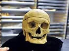The skull of the skeleton found in the Odd Fellows hall in Scio, which is now at Oregon State University. The skeleton was that of a hard-working man who died sometime between 1860 and 1890.